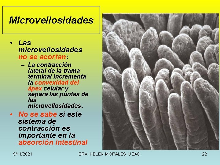 Microvellosidades • Las microvellosidades no se acortan: – La contracción lateral de la trama
