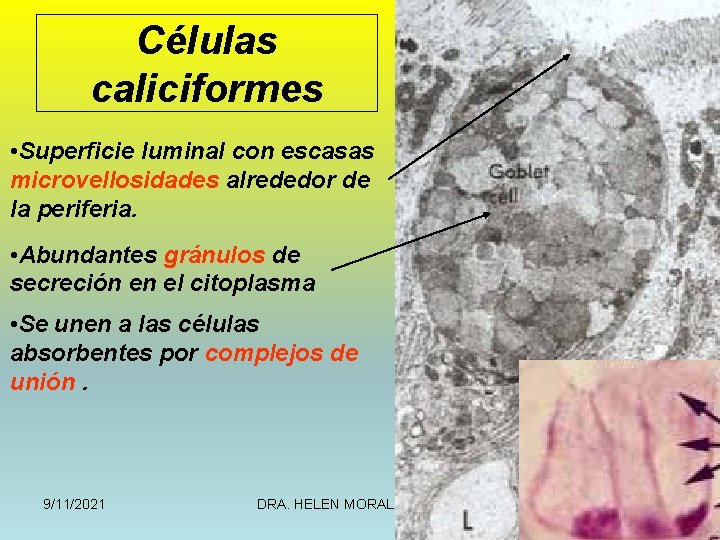 Células caliciformes • Superficie luminal con escasas microvellosidades alrededor de la periferia. • Abundantes