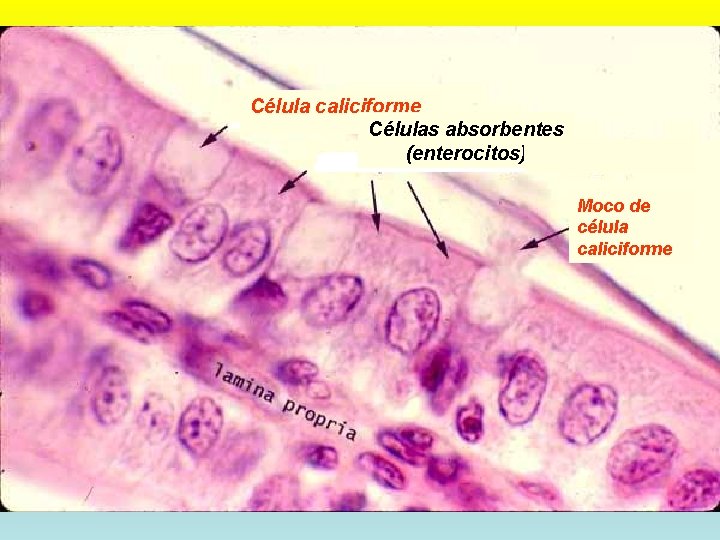 Célula caliciforme Células absorbentes (enterocitos) Moco de célula caliciforme 9/11/2021 DRA. HELEN MORALES, USAC.