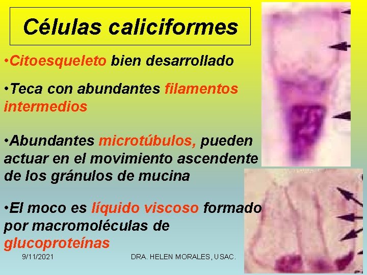 Células caliciformes • Citoesqueleto bien desarrollado • Teca con abundantes filamentos intermedios • Abundantes