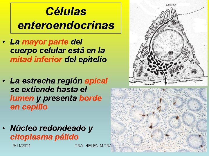 Células enteroendocrinas • La mayor parte del cuerpo celular está en la mitad inferior