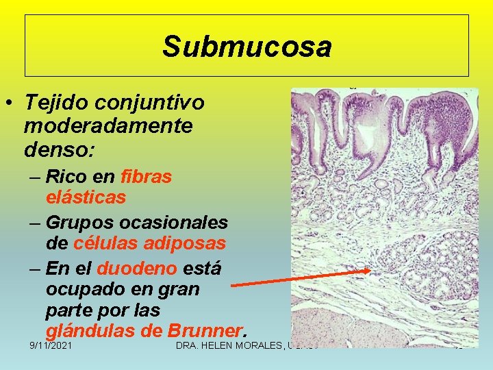 Submucosa • Tejido conjuntivo moderadamente denso: – Rico en fibras elásticas – Grupos ocasionales