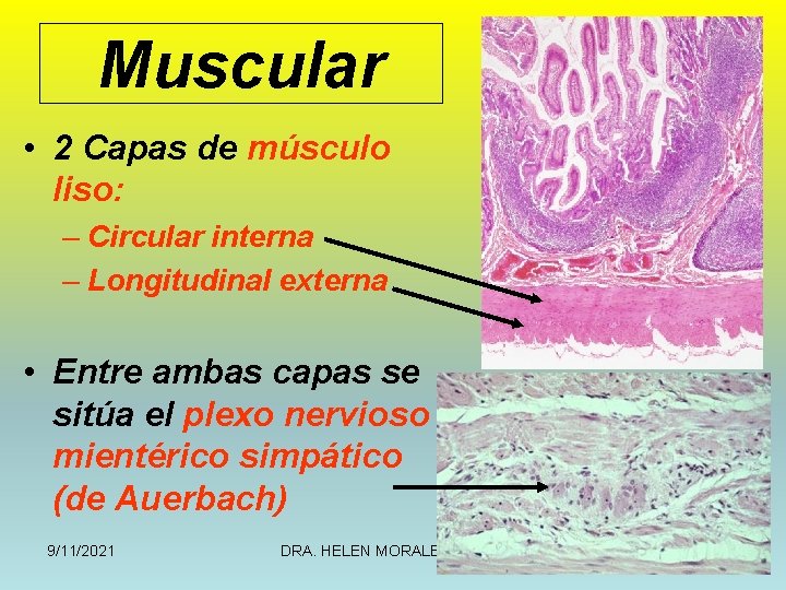 Muscular • 2 Capas de músculo liso: – Circular interna – Longitudinal externa •