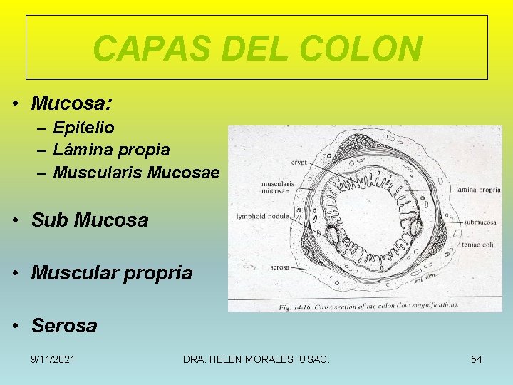 CAPAS DEL COLON • Mucosa: – Epitelio – Lámina propia – Muscularis Mucosae •