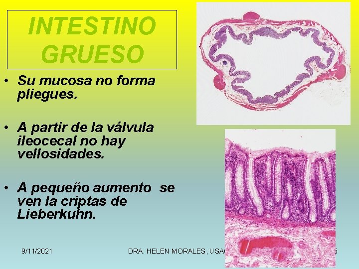 INTESTINO GRUESO • Su mucosa no forma pliegues. • A partir de la válvula