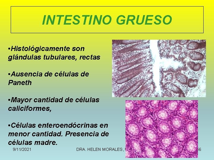 INTESTINO GRUESO • Histológicamente son glándulas tubulares, rectas • Ausencia de células de Paneth