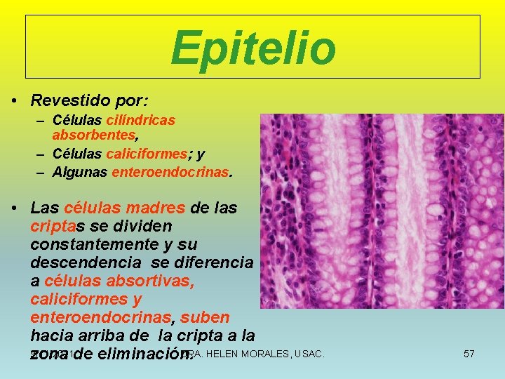 Epitelio • Revestido por: – Células cilíndricas absorbentes, – Células caliciformes; y – Algunas