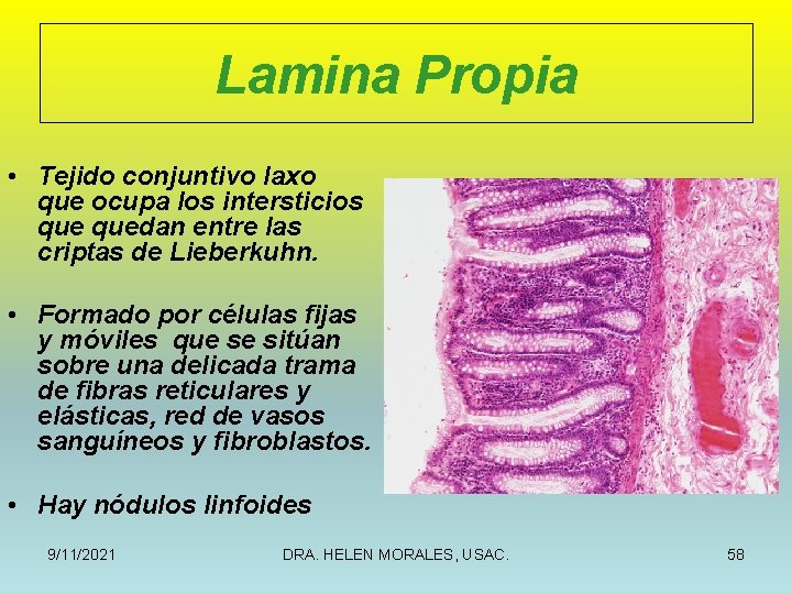 Lamina Propia • Tejido conjuntivo laxo que ocupa los intersticios quedan entre las criptas