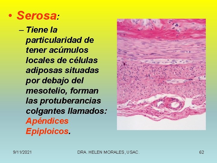  • Serosa: – Tiene la particularidad de tener acúmulos locales de células adiposas