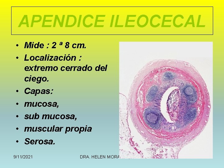 APENDICE ILEOCECAL • Mide : 2 ª 8 cm. • Localización : extremo cerrado