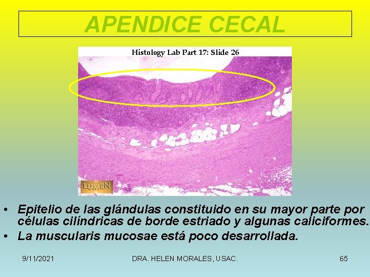 APENDICE CECAL • Epitelio de las glándulas constituido en su mayor parte por células