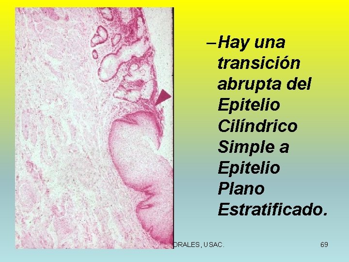 – Hay una transición abrupta del Epitelio Cilíndrico Simple a Epitelio Plano Estratificado. 9/11/2021