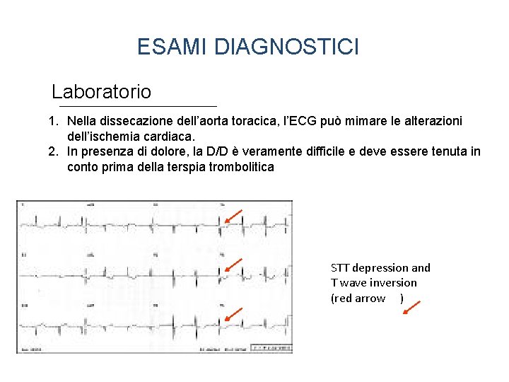 ESAMI DIAGNOSTICI Laboratorio 1. Nella dissecazione dell’aorta toracica, l’ECG può mimare le alterazioni dell’ischemia