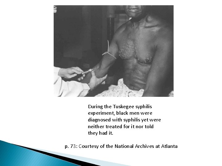 During the Tuskegee syphilis experiment, black men were diagnosed with syphilis yet were neither