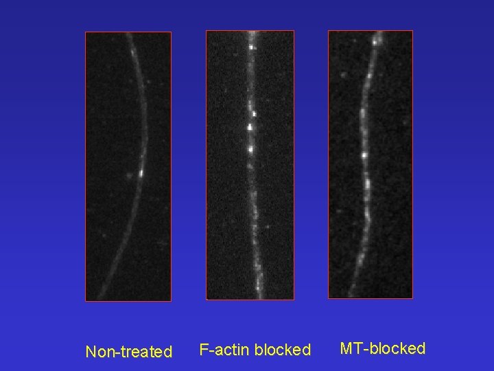 Non-treated F-actin blocked MT-blocked 