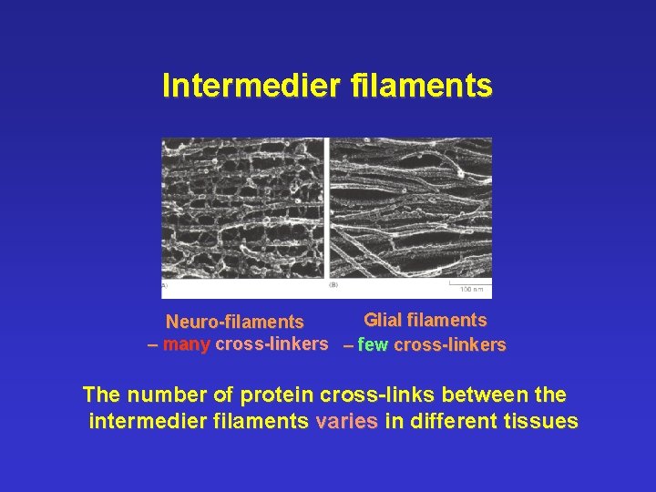 Intermedier filaments Glial filaments Neuro-filaments – many cross-linkers – few cross-linkers The number of