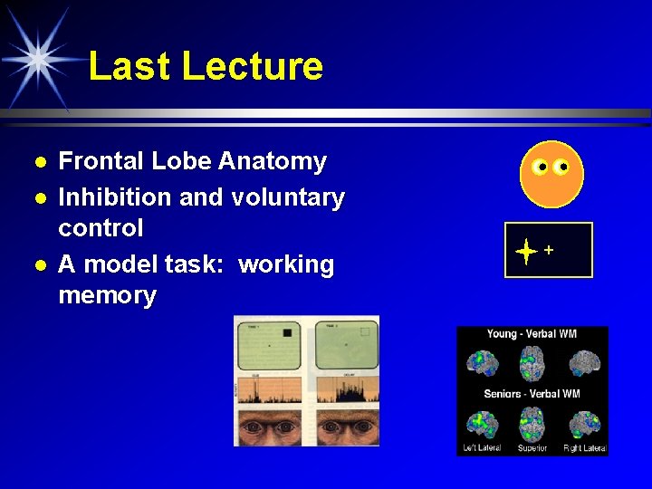 Last Lecture Frontal Lobe Anatomy Inhibition and voluntary control A model task: working memory