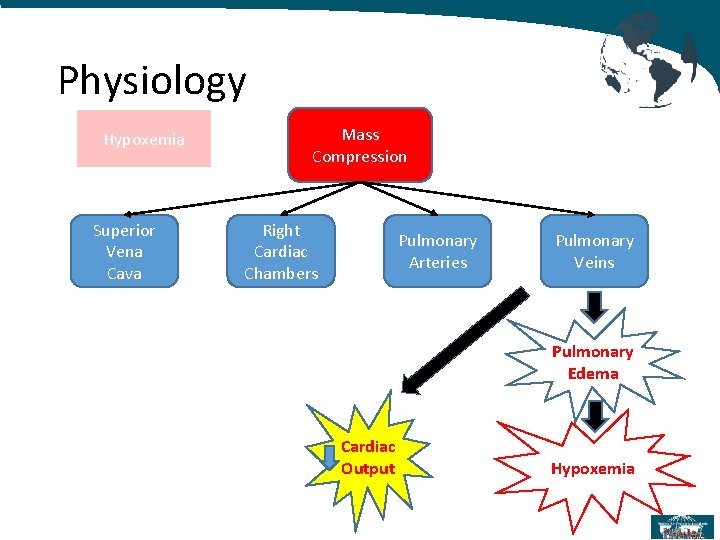 Physiology Hypoxemia Superior Vena Cava Mass Compression Right Cardiac Chambers Pulmonary Arteries Pulmonary Veins