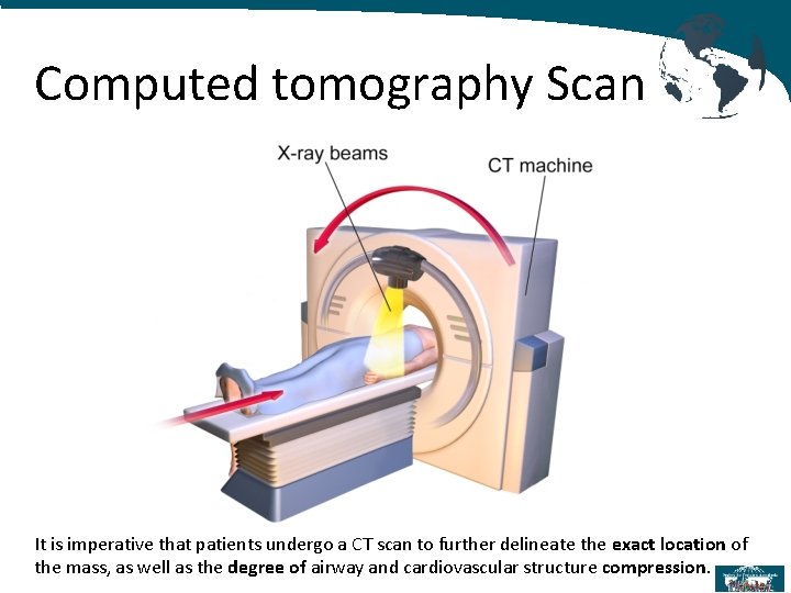 Computed tomography Scan It is imperative that patients undergo a CT scan to further