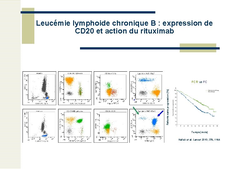 Leucémie lymphoide chronique B : expression de CD 20 et action du rituximab Patients