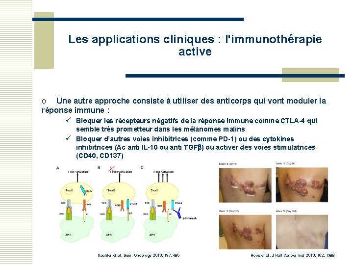 Les applications cliniques : l'immunothérapie active o Une autre approche consiste à utiliser des