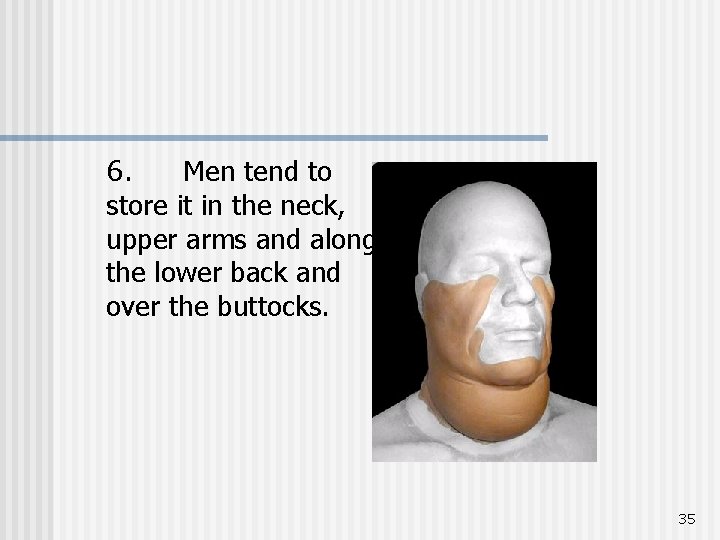 6. Men tend to store it in the neck, upper arms and along the
