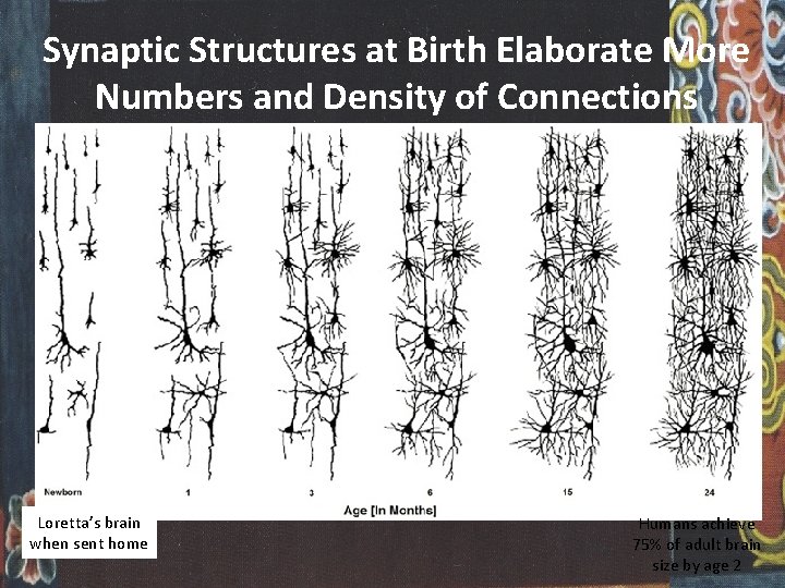 Synaptic Structures at Birth Elaborate More Numbers and Density of Connections Loretta’s brain when