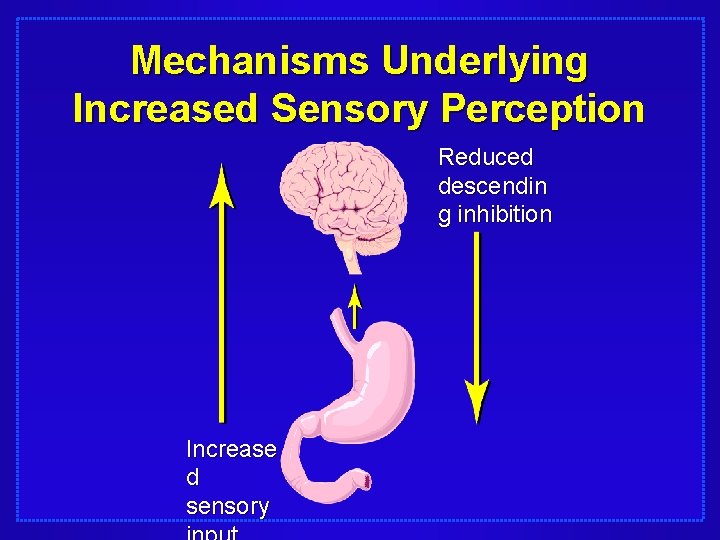 Mechanisms Underlying Increased Sensory Perception Reduced descendin g inhibition Increase d sensory 