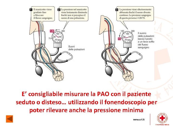 E’ consigliabile misurare la PAO con il paziente seduto o disteso… utilizzando il fonendoscopio