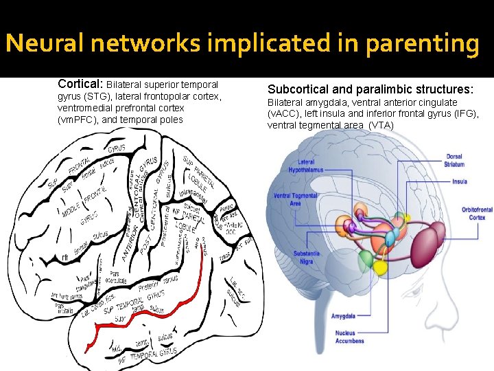 Neural networks implicated in parenting Cortical: Bilateral superior temporal gyrus (STG), lateral frontopolar cortex,