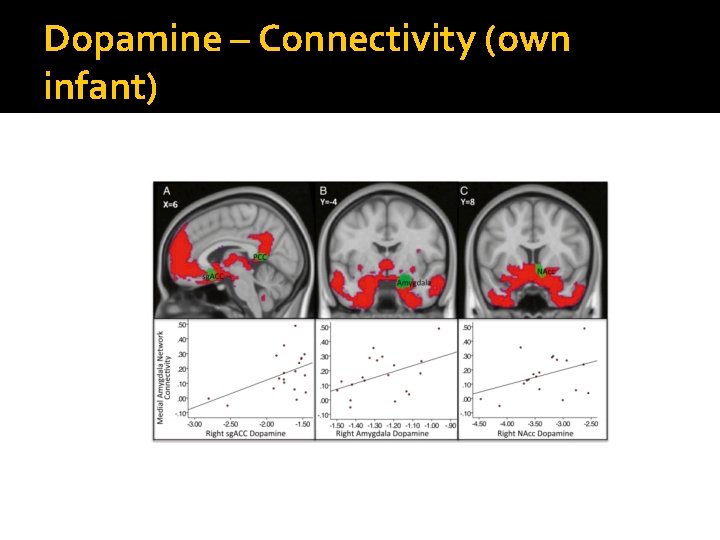 Dopamine – Connectivity (own infant) 