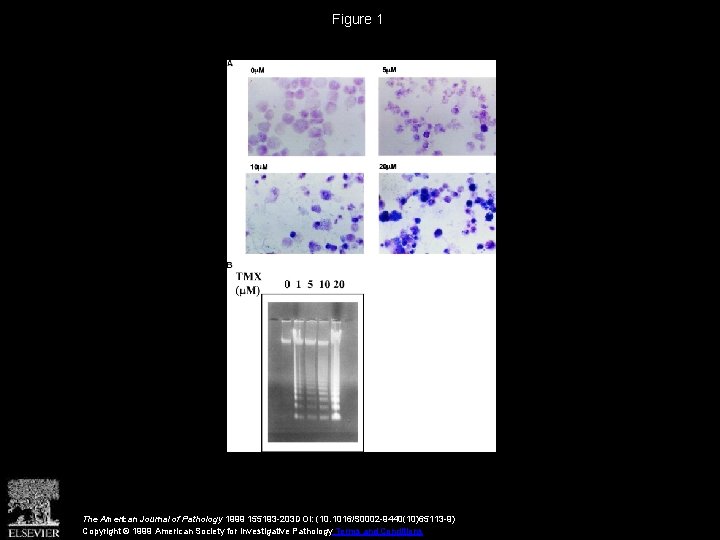 Figure 1 The American Journal of Pathology 1999 155193 -203 DOI: (10. 1016/S 0002