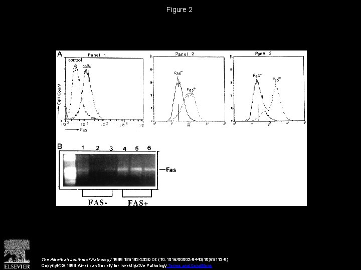 Figure 2 The American Journal of Pathology 1999 155193 -203 DOI: (10. 1016/S 0002