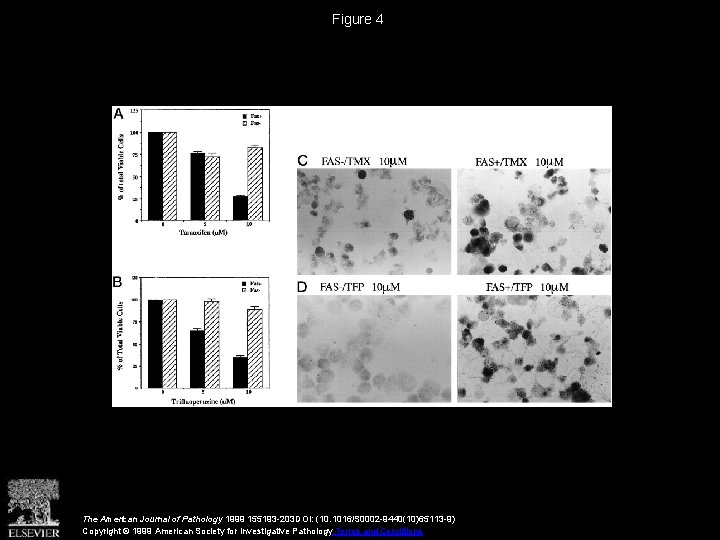 Figure 4 The American Journal of Pathology 1999 155193 -203 DOI: (10. 1016/S 0002