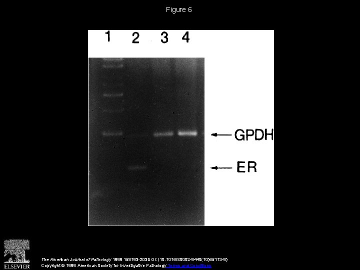 Figure 6 The American Journal of Pathology 1999 155193 -203 DOI: (10. 1016/S 0002