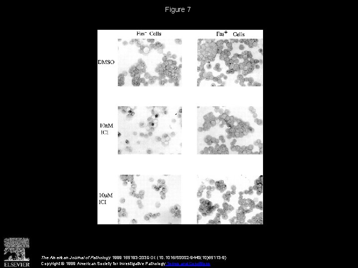 Figure 7 The American Journal of Pathology 1999 155193 -203 DOI: (10. 1016/S 0002