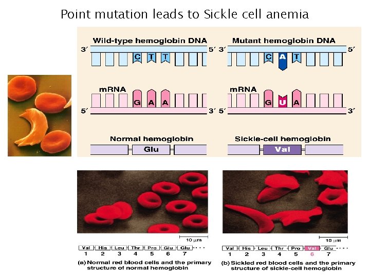 Point mutation leads to Sickle cell anemia Point mutation leads to Sickle cell anemia