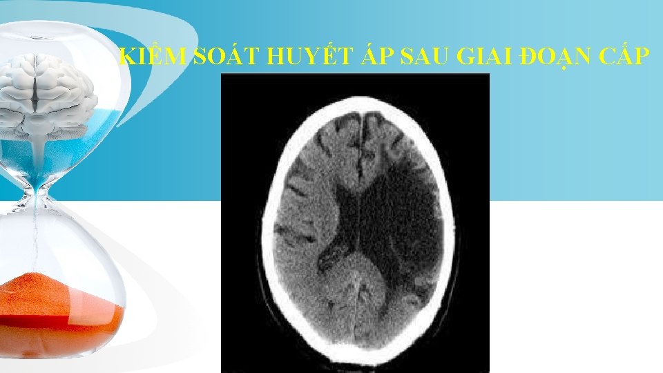 KIỂM SOÁT HUYẾT ÁP SAU GIAI ĐOẠN CẤP 