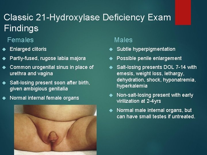 Classic 21 -Hydroxylase Deficiency Exam Findings Females Males Enlarged clitoris Subtle hyperpigmentation Partly-fused, rugose