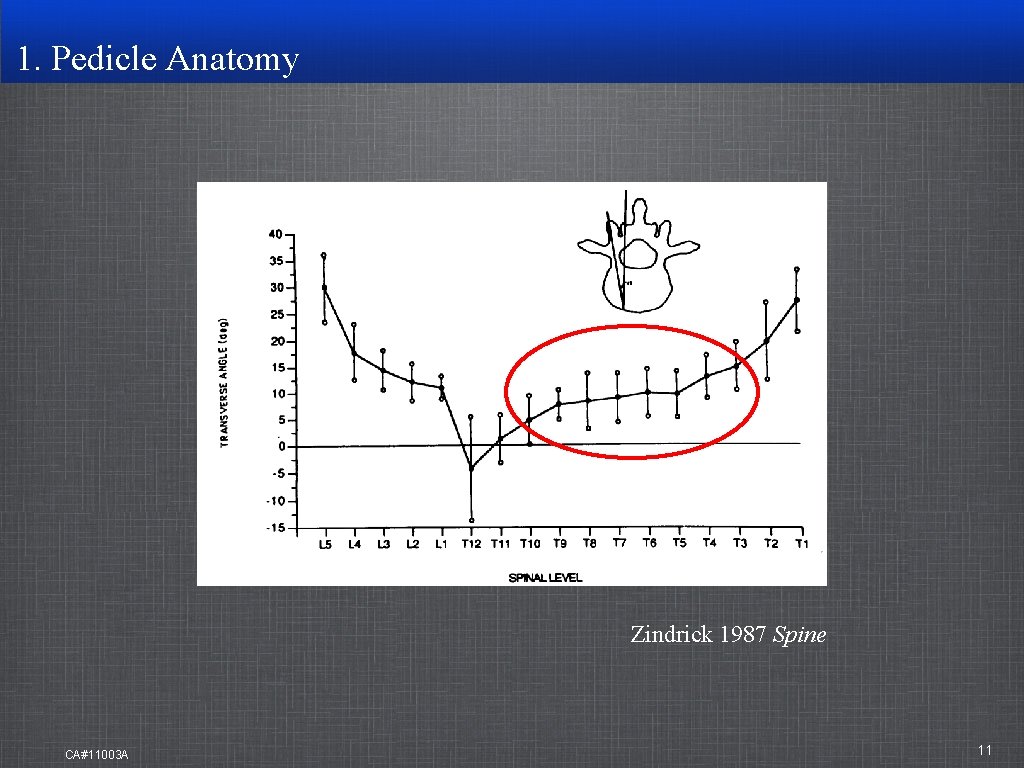 1. Pedicle Anatomy Zindrick 1987 Spine CA#11003 A 11 