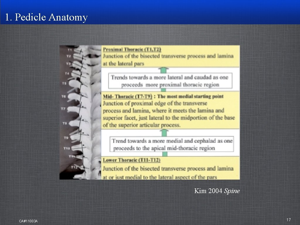 1. Pedicle Anatomy Kim 2004 Spine CA#11003 A 17 