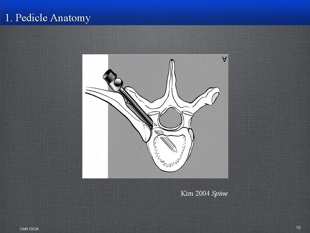 1. Pedicle Anatomy Kim 2004 Spine CA#11003 A 18 