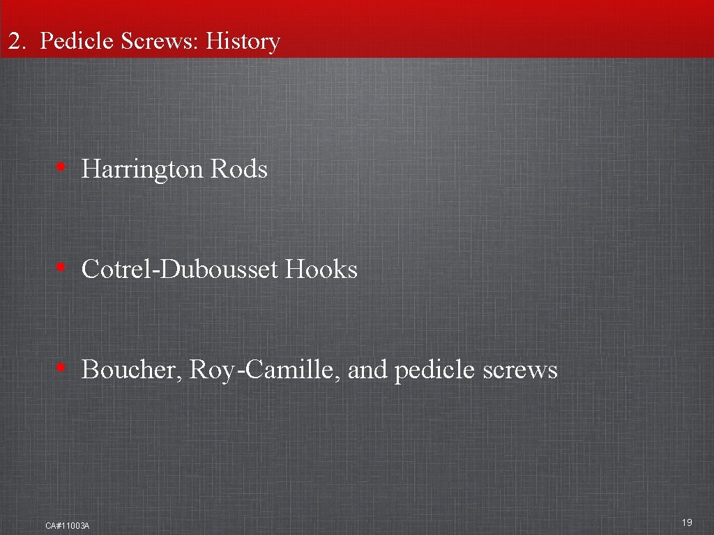 2. Pedicle Screws: History • Harrington Rods • Cotrel-Dubousset Hooks • Boucher, Roy-Camille, and