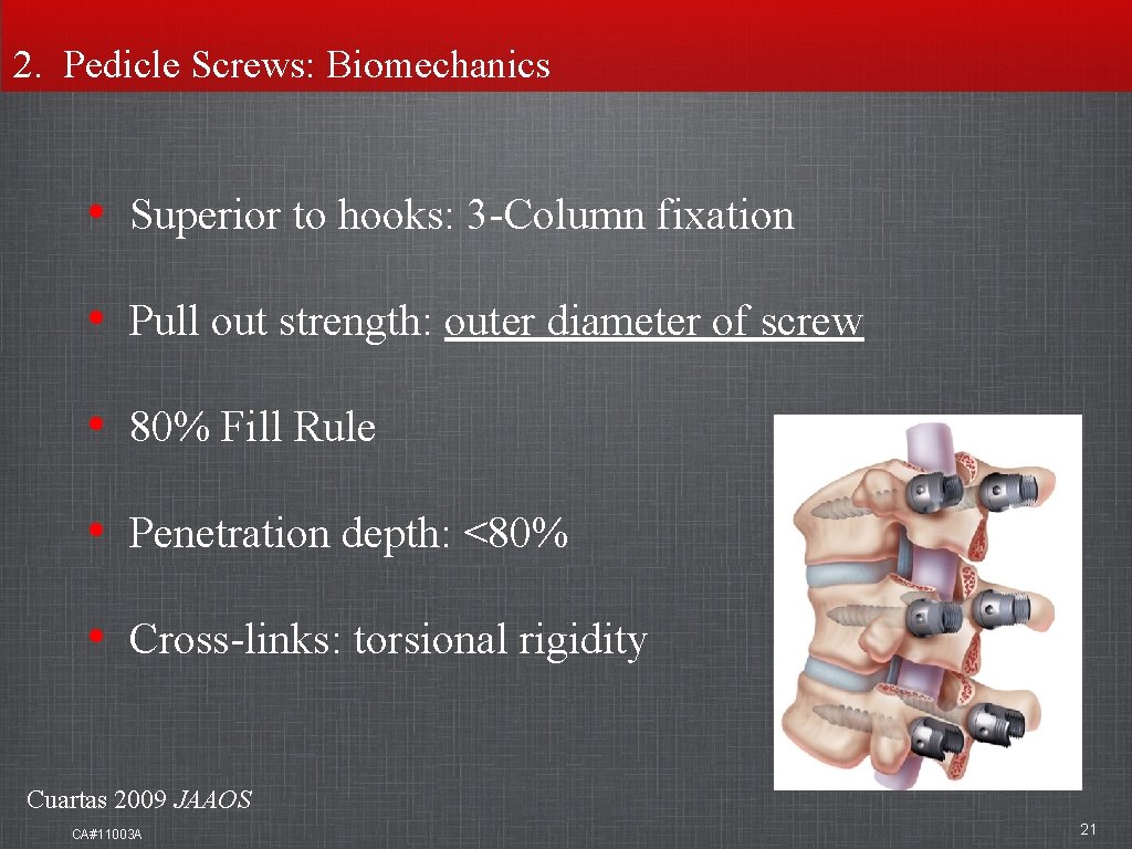 2. Pedicle Screws: Biomechanics • Superior to hooks: 3 -Column fixation • Pull out