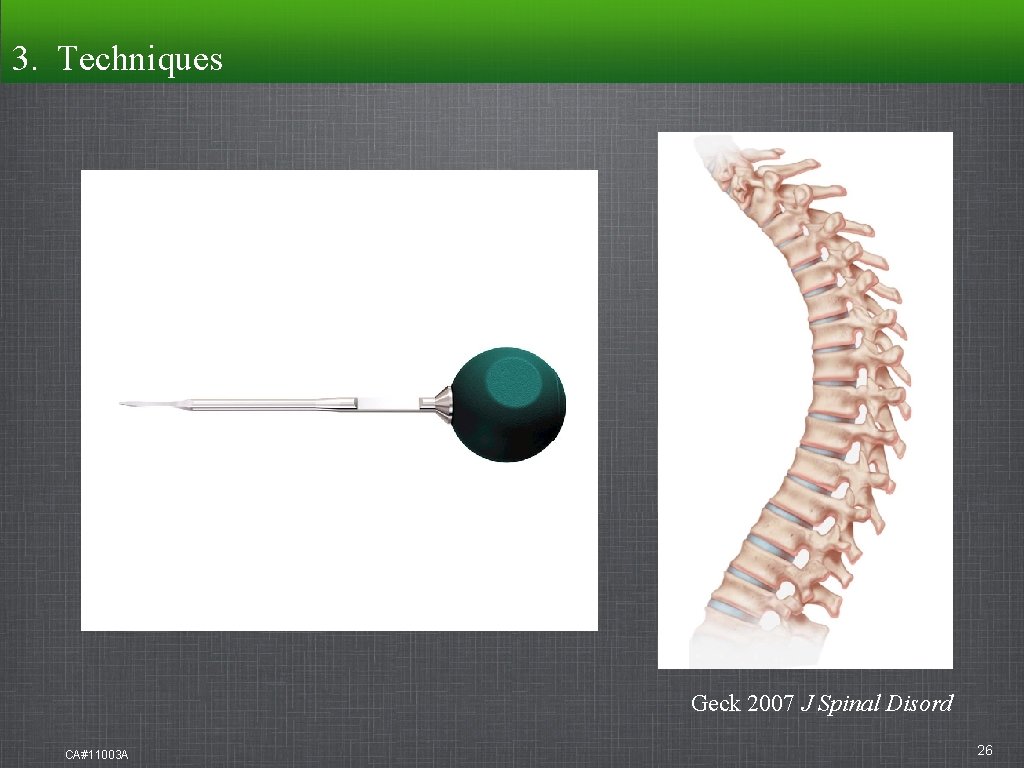 3. Techniques Geck 2007 J Spinal Disord CA#11003 A 26 