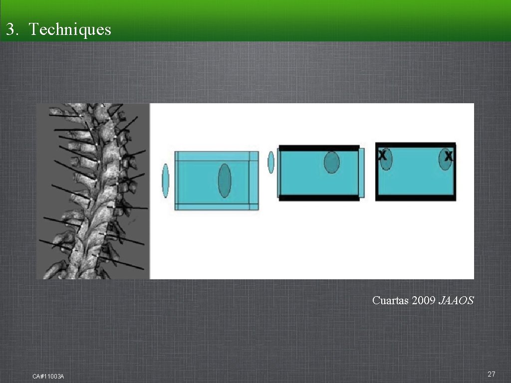 3. Techniques Cuartas 2009 JAAOS CA#11003 A 27 