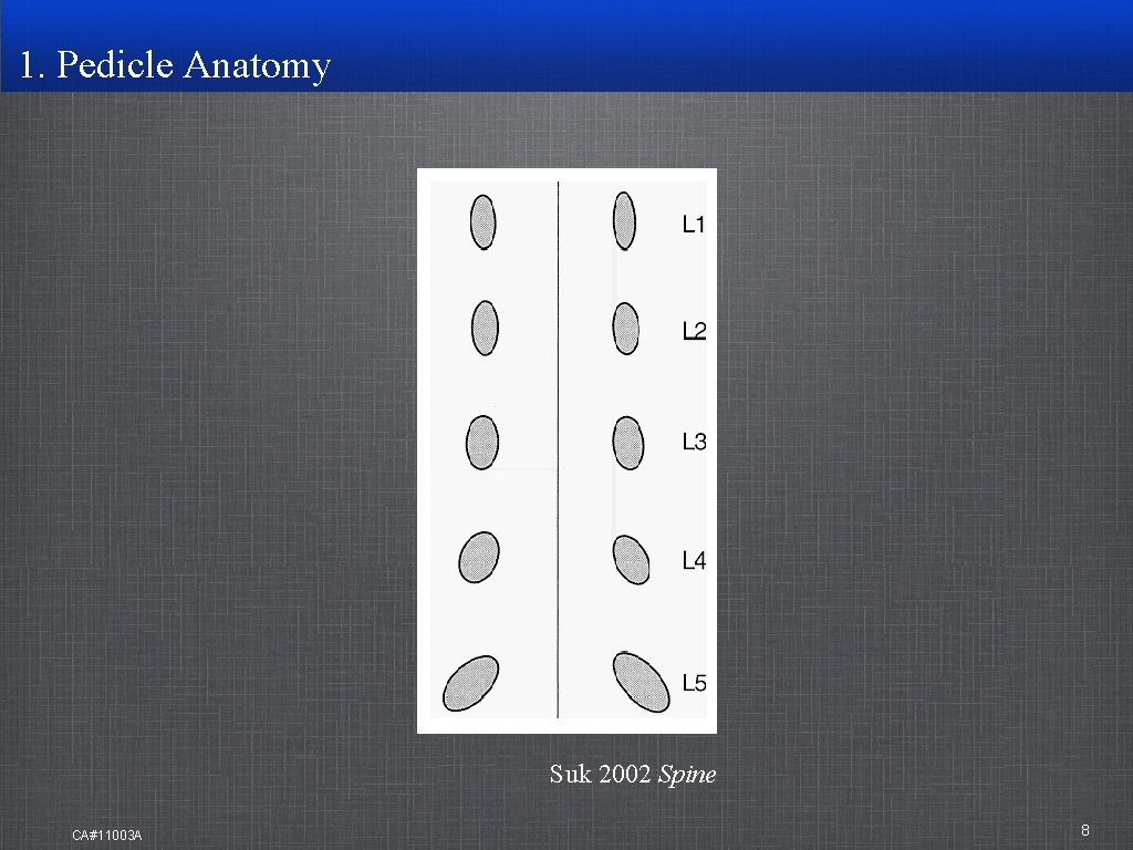 1. Pedicle Anatomy Suk 2002 Spine CA#11003 A 8 