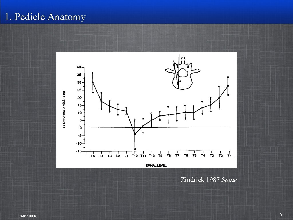 1. Pedicle Anatomy Zindrick 1987 Spine CA#11003 A 9 