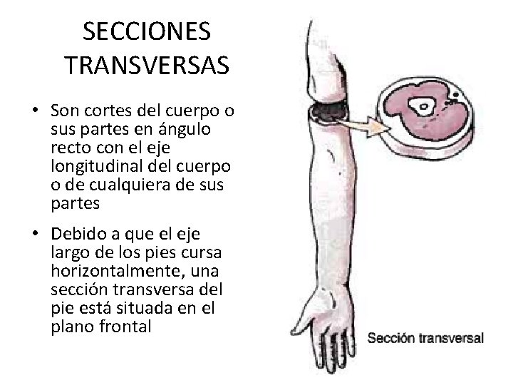 SECCIONES TRANSVERSAS • Son cortes del cuerpo o sus partes en ángulo recto con