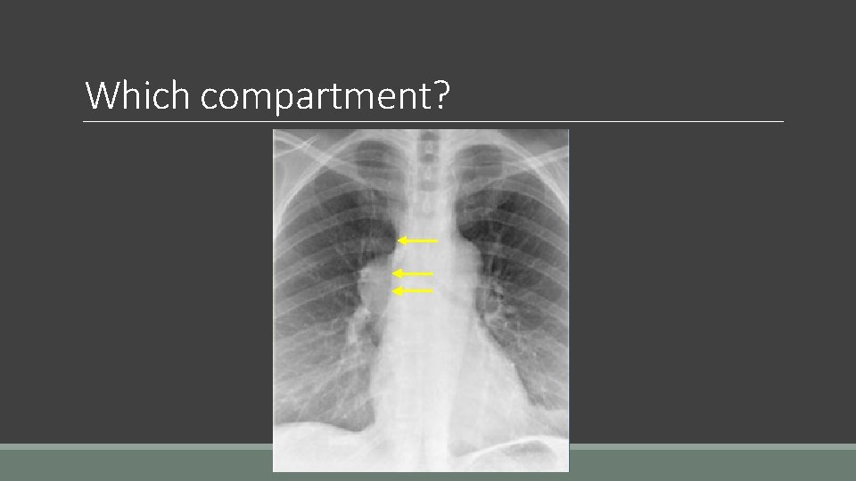 Which compartment? 